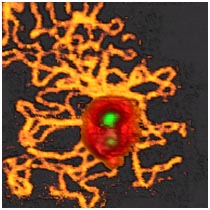 Virus